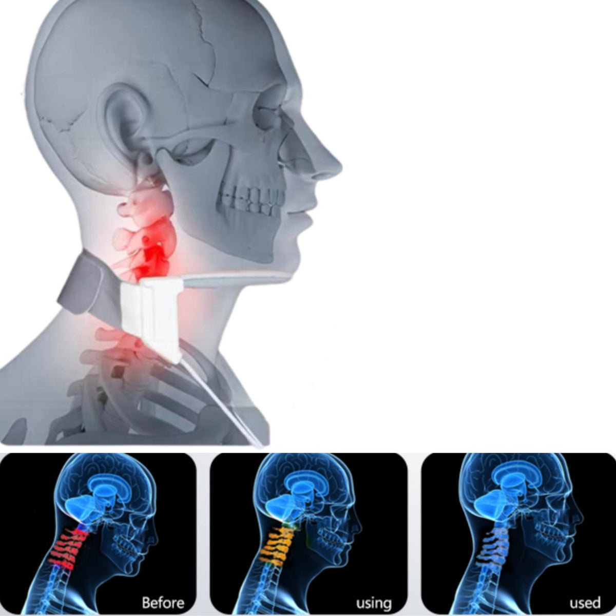 Neck Brace with/without Graphene Heating Pad